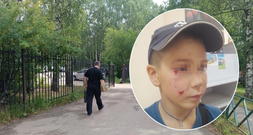 В Ярославле разъяренная собака напала на ребенка