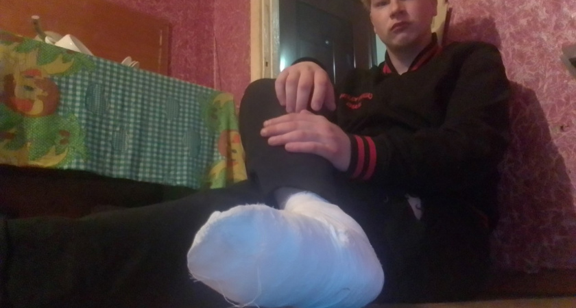Певец из Ярославля: "Мне сломал ногу желтый автобус"