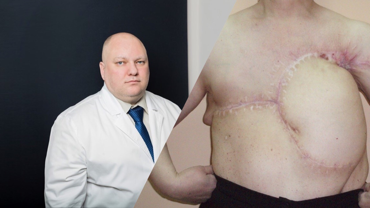 Выживают с раком четвертой степени: врачи из Ярославля показали фото "до" и "после"