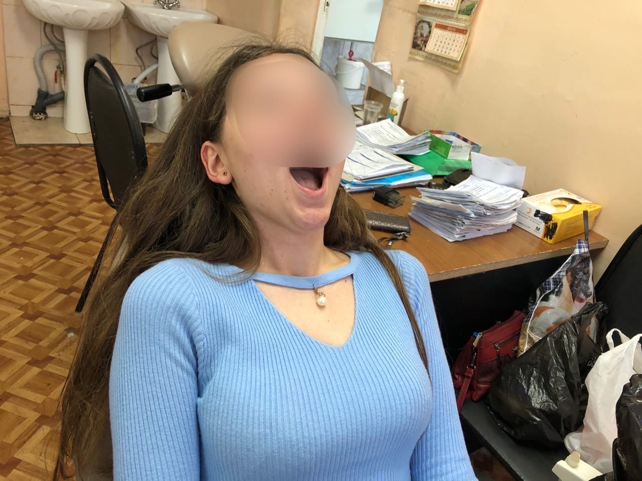 «Он мне рот порвал»: после визита к зубному у ярославны отказало пол-лица