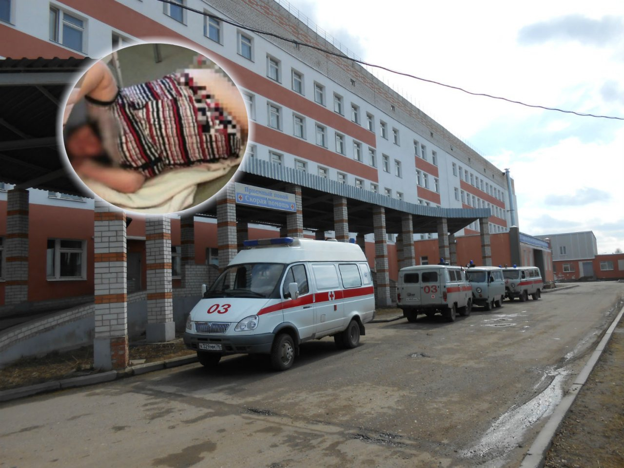 "Она тяжеленная": депздрав пролил свет на скандал с "избиением" пациентки в больнице Гаврилов - Яма