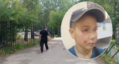 В Ярославле разъяренная собака напала на ребенка