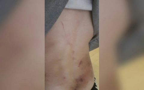 "Что ты стоишь в этой жизни": видео жестокого избиения подростка полицейскими Рыбинска попало в сеть